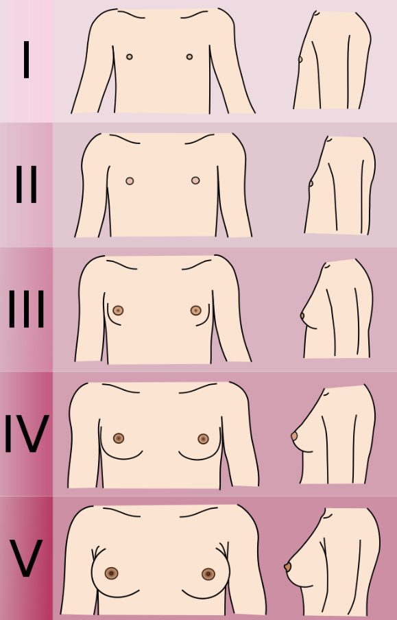 Adolescent Breast Problems Military Obstetrics Gynecology